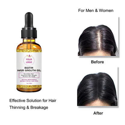 Biotin Hair Growth Oil-30ml/60ml