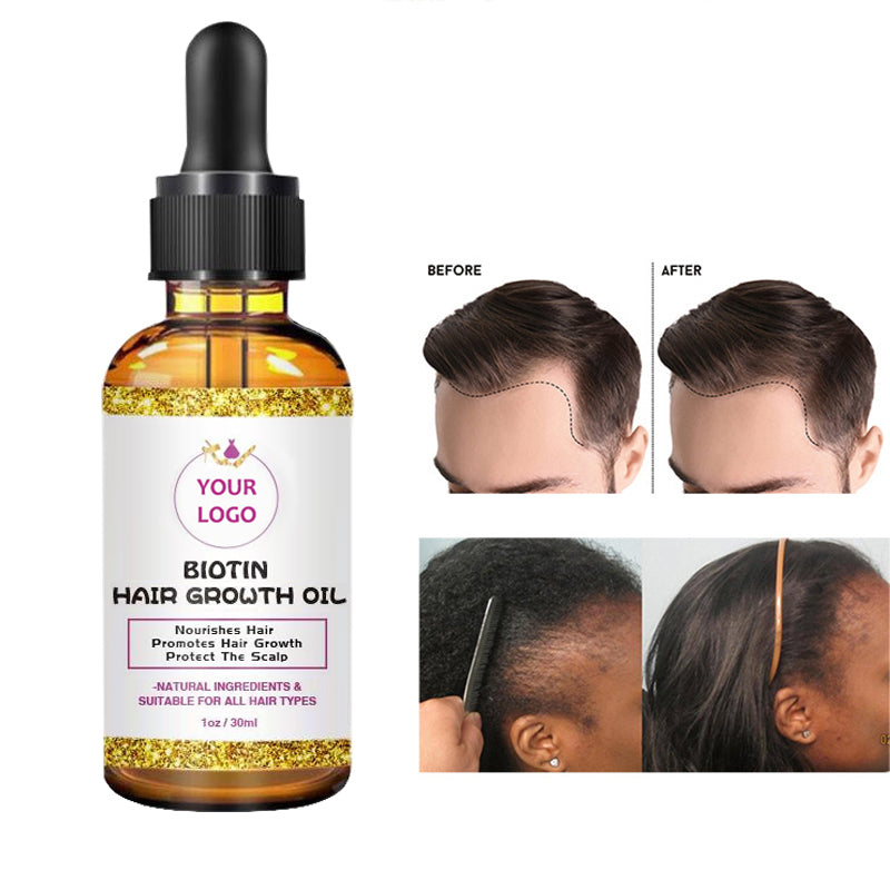 Biotin Hair Growth Oil-30ml/60ml